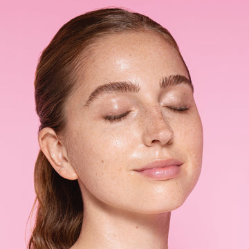 Kémiai hámlasztás versus nyár – szabad hámlasztanom nyáron?