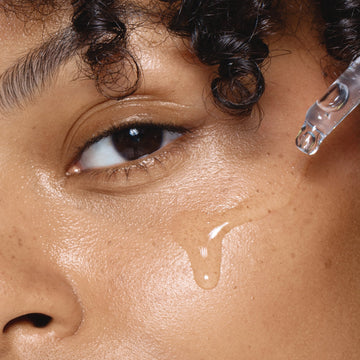 Pattanások egy terméktől: kezdeti rosszabbodás vagy sem? (Honnan tudhatod, hogy melyik? - Purging)